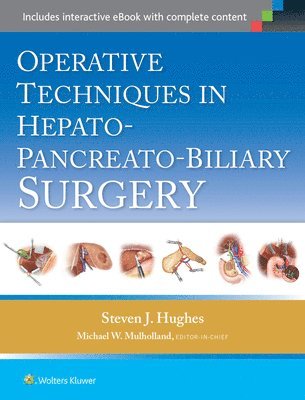 Operative Techniques in Hepato-Pancreato-Biliary Surgery 1