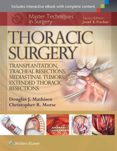 bokomslag Master Techniques in Surgery: Thoracic Surgery: Transplantation, Tracheal Resections, Mediastinal Tumors, Extended Thoracic Resections