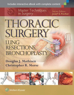 Master Techniques in Surgery: Thoracic Surgery: Lung Resections, Bronchoplasty 1