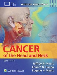 bokomslag Cancer of the Head and Neck