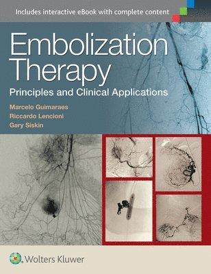 Embolization Therapy: Principles and Clinical Applications 1