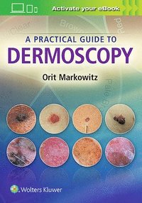 bokomslag A Practical Guide to Dermoscopy