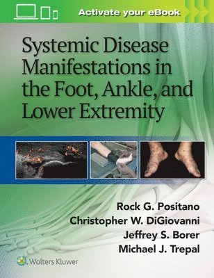 Rock G. Positano, Jeffrey Borer, Christopher DiGiovanni, Michael Trepal, MD Trepal, Michael - Systemic Disease Manifestations in the Foot, Ankle, and Lower Extremity, Inbunden