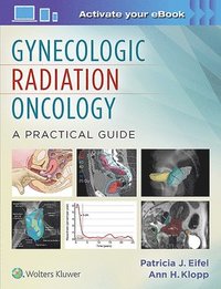 bokomslag Gynecologic Radiation Oncology: A Practical Guide