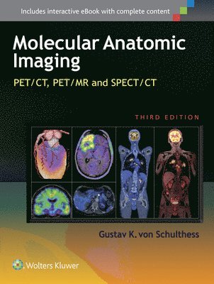 Molecular Anatomic Imaging 1