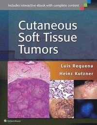 bokomslag Cutaneous Soft Tissue Tumors