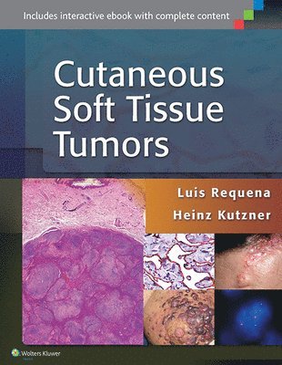 Cutaneous Soft Tissue Tumors 1
