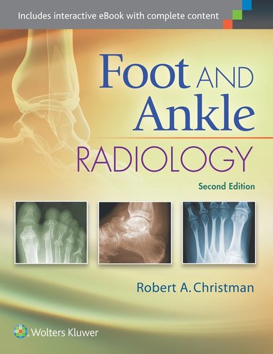 Robert Christman - Foot and Ankle Radiology, Inbunden