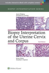bokomslag Biopsy Interpretation of the Uterine Cervix and Corpus