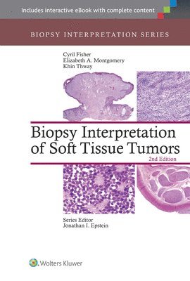 Biopsy Interpretation of Soft Tissue Tumors 1