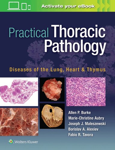 Allen P. Burke, Marie-Christine Aubry, Joseph Maleszewski, Borislav Alexiev, Fabio Tavora - Practical Thoracic Pathology, Inbunden