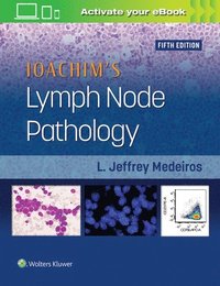 bokomslag Ioachim's Lymph Node Pathology