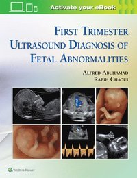 bokomslag First Trimester Ultrasound Diagnosis of Fetal Abnormalities