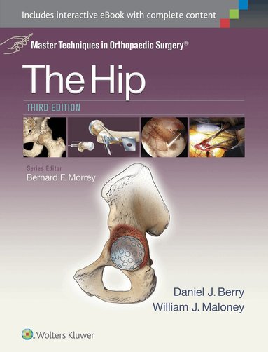 Daniel J. Berry, William Maloney - Master Techniques in Orthopaedic Surgery: The Hip, Inbunden