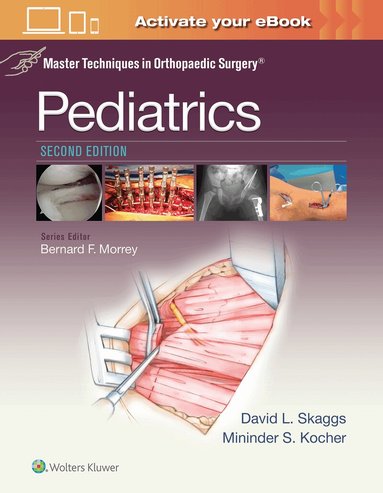 David L. Skaggs, Mininder Kocher - Master Techniques in Orthopaedic Surgery: Pediatrics, Inbunden