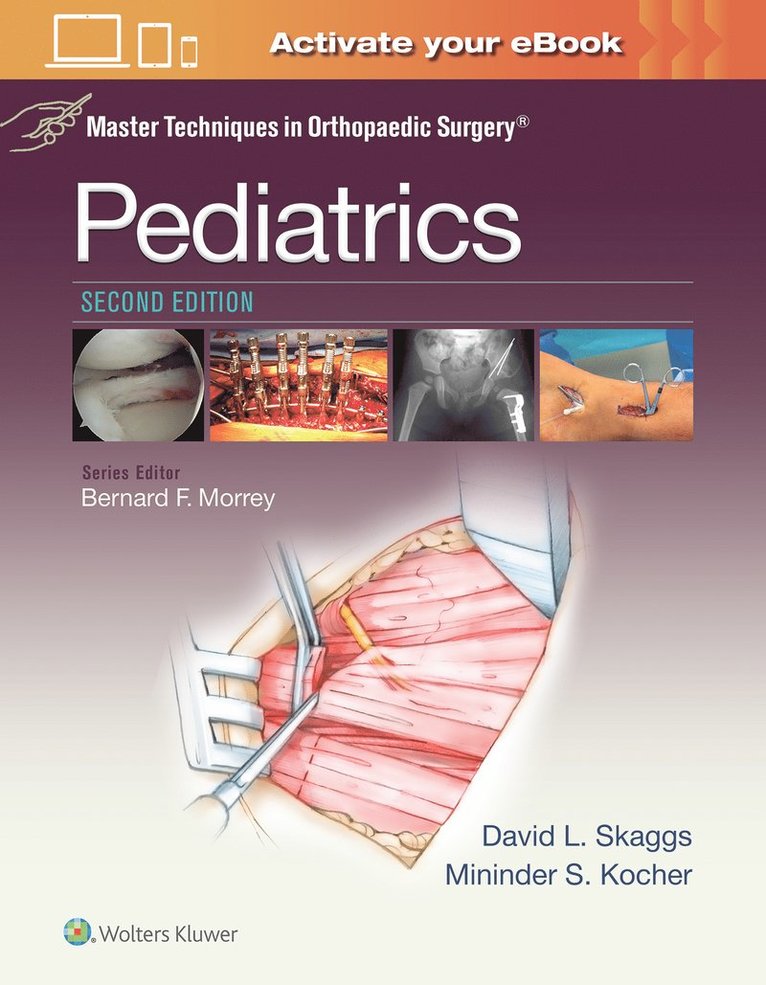 Master Techniques in Orthopaedic Surgery: Pediatrics