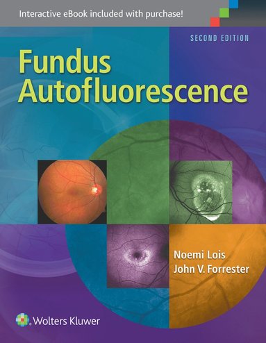 bokomslag Fundus Autofluorescence