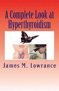 bokomslag A Complete Look at Hyperthyroidism: Overactive Thyroid Symptoms and Treatments