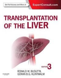 bokomslag Transplantation of the Liver