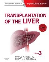 Ronald W. Busuttil, Goran B. Klintmalm - Transplantation of the Liver, Inbunden
