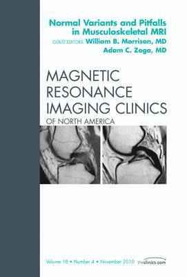 William B. Morrison, Adam C. Zoga - Normal Variants and Pitfalls in Musculoskeletal MRI, An Issue of Magnetic Resonance Imaging Clinics, Inbunden