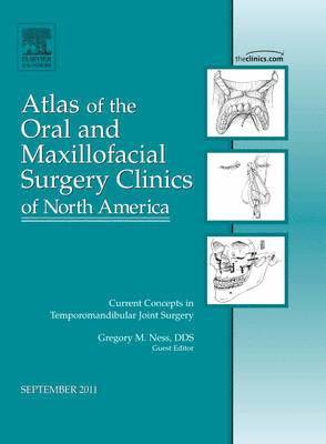 Current Concepts in Temporomandibular Joint Surgery, An Issue of Atlas of the Oral and Maxillofacial Surgery Clinics 1