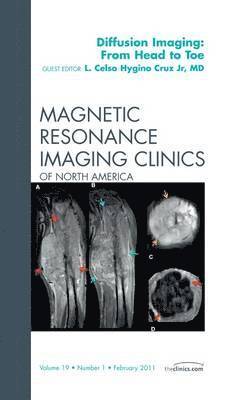 bokomslag Clinical Applications of Diffusion Imaging: from Head to Toe, An Issue of Magnetic Resonance Imaging Clinics