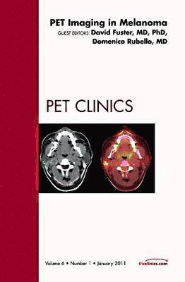 Domenico Rubello, David Fuster - Pet Imaging in Melanoma, An Issue of PET Clinics, Inbunden