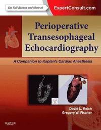 bokomslag Perioperative Transesophageal Echocardiography