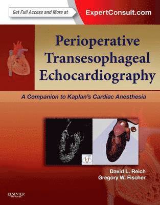 bokomslag Perioperative Transesophageal Echocardiography