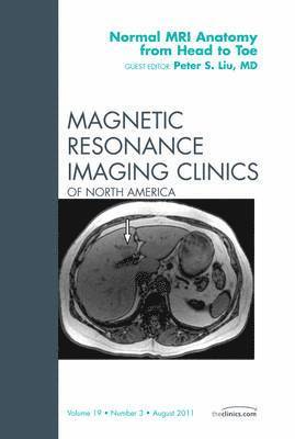 bokomslag Normal MR Anatomy from Head to Toe, An Issue of Magnetic Resonance Imaging Clinics