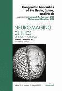 Congenital Anomalies of the Brain, Spine, and Neck, An Issue of Neuroimaging Clinics 1