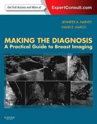 bokomslag Making the Diagnosis: A Practical Guide to Breast Imaging