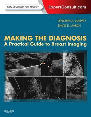 Making the Diagnosis: A Practical Guide to Breast Imaging 1