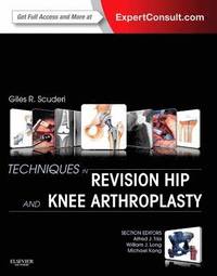 bokomslag Techniques in Revision Hip and Knee Arthroplasty