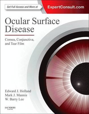 Ocular Surface Disease: Cornea, Conjunctiva and Tear Film 1