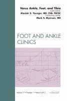 Alastair S. E. Younger - Varus Foot, Ankle, and Tibia, An Issue of Foot and Ankle Clinics, Inbunden