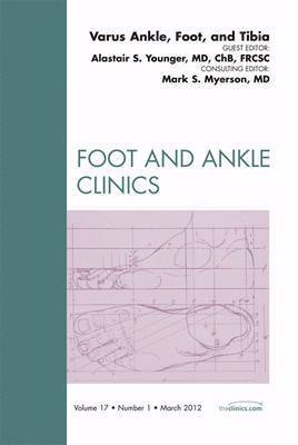 Alastair S. E. Younger, Alastair S E Younger - Varus Foot, Ankle, and Tibia, An Issue of Foot and Ankle Clinics, Inbunden