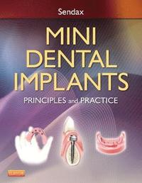 bokomslag Mini Dental Implants