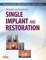 bokomslag Principles and Practice of Single Implant and Restoration