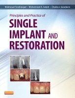 Mahmoud Torabinejad, Mohammed Sabeti, Charles Goodacre - Principles and Practice of Single Implant and Restoration, Inbunden