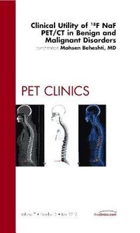 bokomslag Clinical Utility of 18NaF PET/CT in Benign and Malignant Disorders, An Issue of PET Clinics