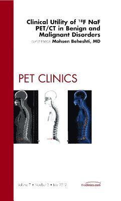 bokomslag Clinical Utility of 18NaF PET/CT in Benign and Malignant Disorders, An Issue of PET Clinics