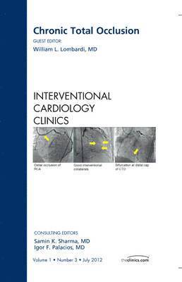 William L. Lombardi, William L Lombardi - Chronic Total Occlusion, An issue of Interventional Cardiology Clinics, Inbunden