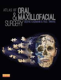 bokomslag Atlas of Oral and Maxillofacial Surgery