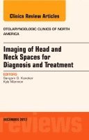 Sangam Kanekar, Kyle Mannion - Imaging of Head and Neck Spaces for Diagnosis and Treatment, An Issue of Otolaryngologic Clinics, Inbunden