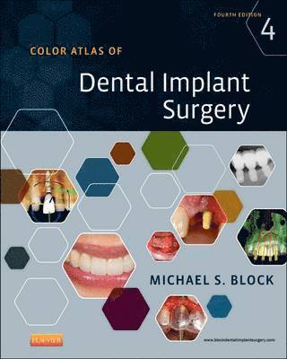 Color Atlas of Dental Implant Surgery 1