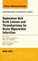 Samir R. Kapadia, Amar Krishnaswamy - Saphenous Vein Graft Lesions and Thrombectomy for Acute Myocardial Infarction, An Issue of Interventional Cardiology Clinics, Inbunden