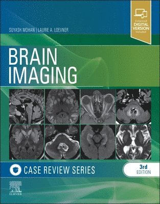 Brain Imaging: Case Review Series 1