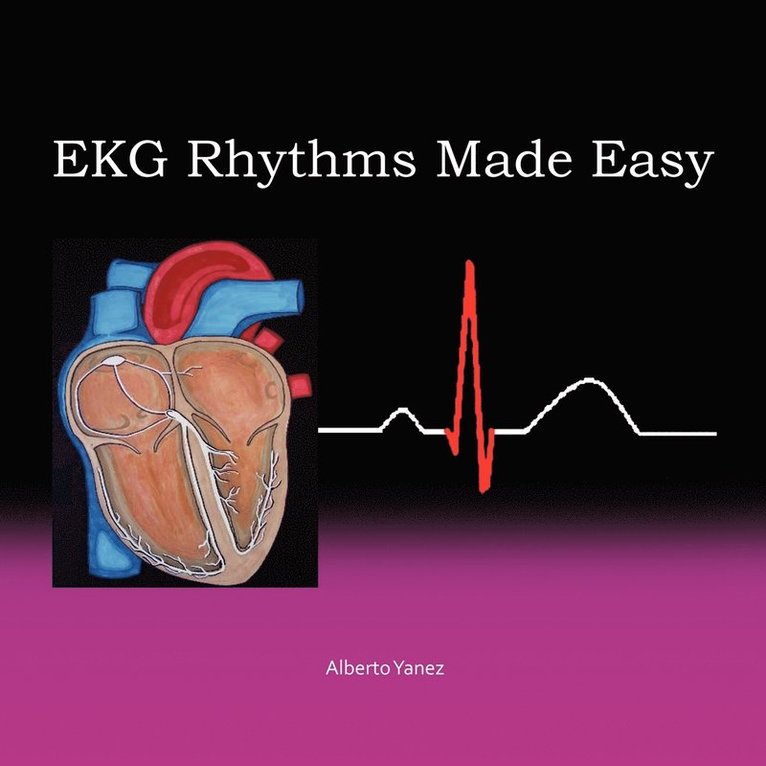Alberto Yanez - EKG Rhythms Made Easy, Häftad
